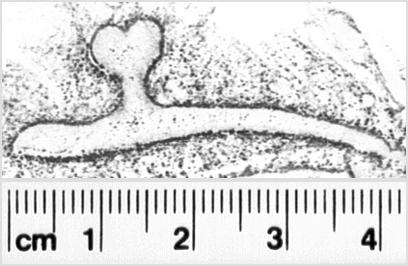 Image Description for https://www.hist-einband.de/Bilder/SBB/MIG/terminologie/bilder/s00240.jpg